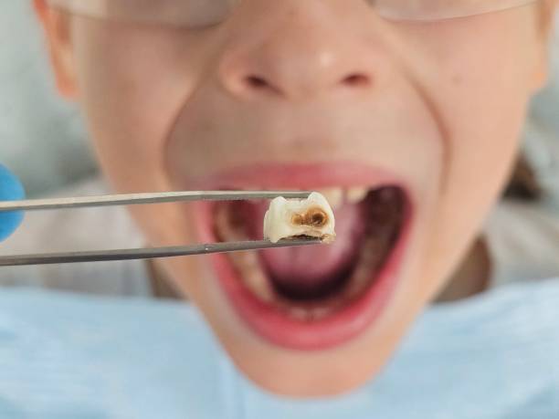 Best Emergency Pediatric Dentist  in Hinton, OK